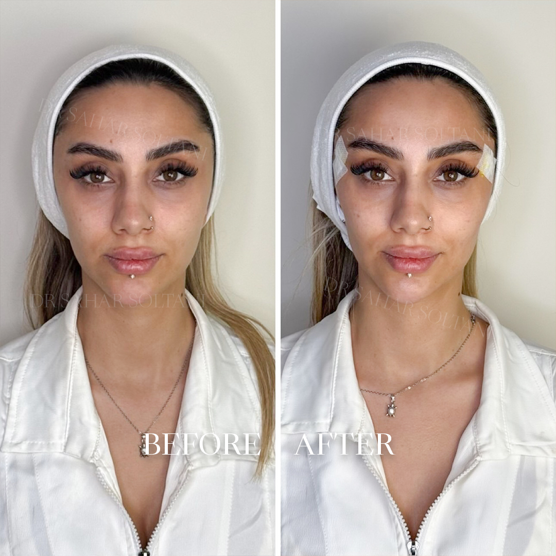 نــــــخ لیــــــفت